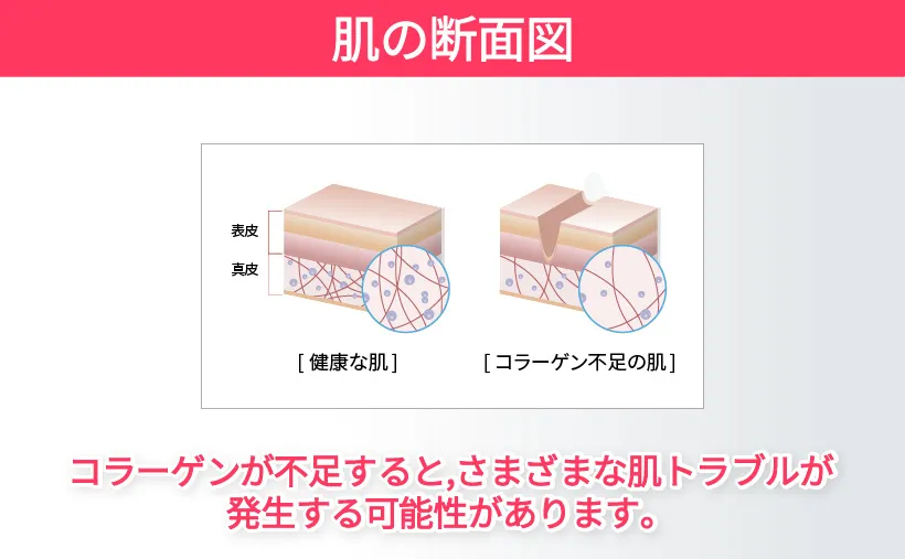 [ビューディアニ] インフュージングコラーゲンコンセントレートフルードフルイド | 詳細画像8